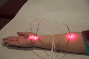 Rehabilitation Therapy | Pain Doctors Brooklyn NYC