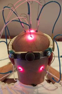 Rehabilitation Therapy | Pain Doctors Brooklyn NYC