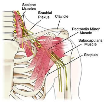 Electrical Nerve Stimulation (Chronic Pain Doctors) Brooklyn NYC