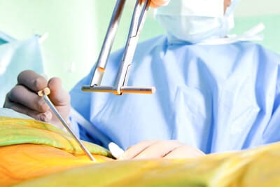 Minimally Invasive Back, Spine Surgery
