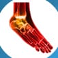 Diabetic Neuropathy in Brooklyn NYC