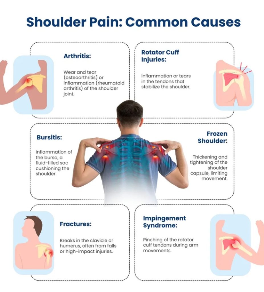 What Causes Shoulder Pain